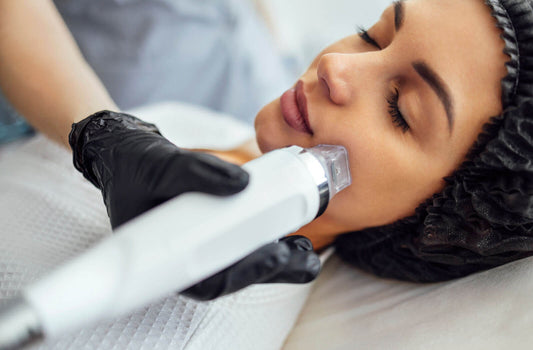 Woman laying down during microneedling treatment