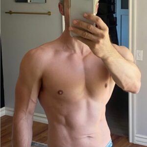 CoolSculpting After 1