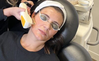 Radiant Skin with Intense Pulsed Light Laser: The Benefits of Laser Treatments