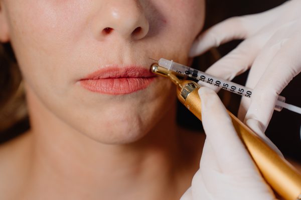 Patient Getting Lip Filler